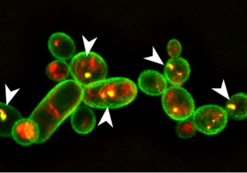 Identifican la molécula de una bacteria capaz de eliminar hongos y nematodos en varios cultivos