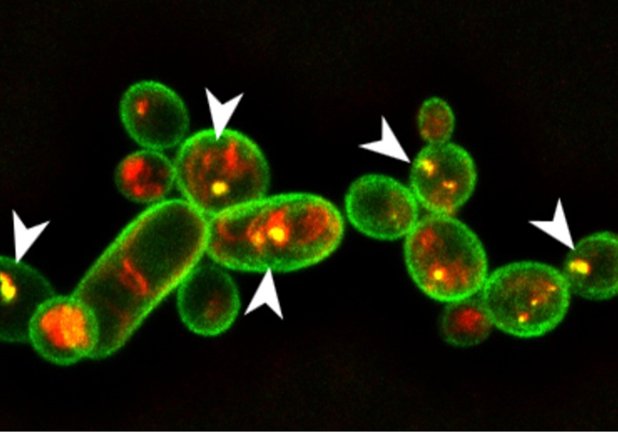 Identifican la molécula de una bacteria capaz de eliminar hongos y nematodos en varios cultivos